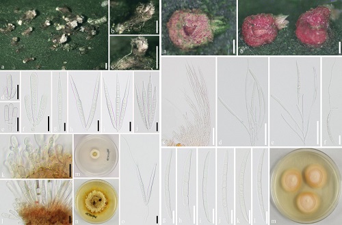 两种真菌的形态解剖图.jpg